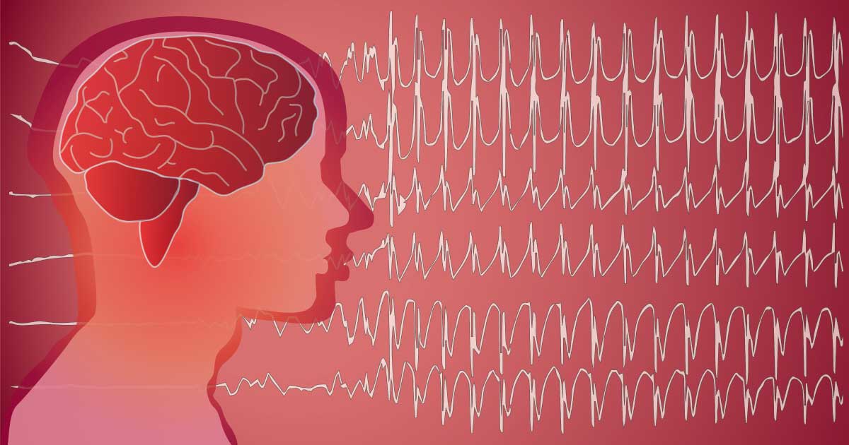 desenho em fundo rosa de uma cabeça, um cérebro e ondas de exame de eletroencefalograma